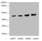 Protein Phosphatase, Mg2+/Mn2+ Dependent 1A antibody, LS-C676296, Lifespan Biosciences, Western Blot image 