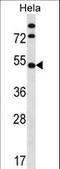 IPK6 antibody, LS-C165259, Lifespan Biosciences, Western Blot image 