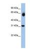 Dehydrogenase/Reductase 2 antibody, NBP1-54922, Novus Biologicals, Western Blot image 