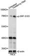 Serum Response Factor antibody, LS-C750635, Lifespan Biosciences, Western Blot image 