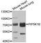 Phosphatidylinositol-4-Phosphate 5-Kinase Type 1 Beta antibody, A08932, Boster Biological Technology, Western Blot image 