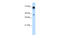 Pseudouridine Synthase 7 antibody, 30-184, ProSci, Enzyme Linked Immunosorbent Assay image 