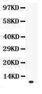 Prolactin antibody, PB9411, Boster Biological Technology, Western Blot image 