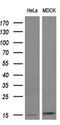 Follicle Stimulating Hormone Subunit Beta antibody, GTX84474, GeneTex, Western Blot image 