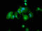 Thioredoxin Interacting Protein antibody, LS-C671905, Lifespan Biosciences, Immunofluorescence image 