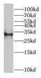 Gem Nuclear Organelle Associated Protein 8 antibody, FNab03423, FineTest, Western Blot image 