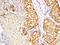 Protein Kinase C Delta antibody, LS-C175895, Lifespan Biosciences, Immunohistochemistry paraffin image 