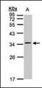 Calcium Voltage-Gated Channel Auxiliary Subunit Gamma 5 antibody, orb89511, Biorbyt, Western Blot image 