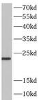 Stathmin-2 antibody, FNab08340, FineTest, Western Blot image 