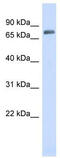 E3 ubiquitin-protein ligase TRIM41 antibody, TA338170, Origene, Western Blot image 