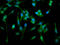 Actin Related Protein 2/3 Complex Subunit 4 antibody, LS-C672510, Lifespan Biosciences, Immunofluorescence image 