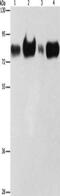 Acyl-CoA Synthetase Long Chain Family Member 4 antibody, CSB-PA289963, Cusabio, Western Blot image 