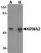 Karyopherin Subunit Alpha 2 antibody, PA5-21034, Invitrogen Antibodies, Western Blot image 