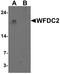 WAP Four-Disulfide Core Domain 2 antibody, PA5-72770, Invitrogen Antibodies, Western Blot image 