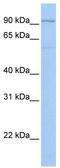 Tetratricopeptide Repeat Domain 16 antibody, TA329582, Origene, Western Blot image 