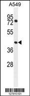 GTP Binding Protein 8 (Putative) antibody, MBS9211655, MyBioSource, Western Blot image 