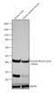 Actin Alpha 2, Smooth Muscle antibody, MA5-15806, Invitrogen Antibodies, Western Blot image 