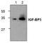 Insulin Like Growth Factor Binding Protein 5 antibody, TA319122, Origene, Western Blot image 