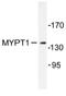 Protein Phosphatase 1 Regulatory Subunit 12A antibody, AP06543PU-N, Origene, Western Blot image 