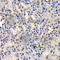 DEAD-Box Helicase 41 antibody, A6576, ABclonal Technology, Immunohistochemistry paraffin image 