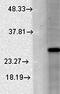 Potassium Calcium-Activated Channel Subfamily M Regulatory Beta Subunit 2 antibody, orb67419, Biorbyt, Western Blot image 