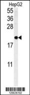 SFT2 Domain Containing 3 antibody, 61-864, ProSci, Western Blot image 