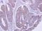 Lactamase Beta 2 antibody, NBP2-19319, Novus Biologicals, Immunohistochemistry paraffin image 