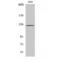 Protein Tyrosine Kinase 2 antibody, LS-C383466, Lifespan Biosciences, Western Blot image 
