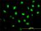 Zinc finger FYVE domain-containing protein 19 antibody, H00084936-M01, Novus Biologicals, Immunofluorescence image 