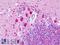 Ubiquitin C-Terminal Hydrolase L1 antibody, LS-B9320, Lifespan Biosciences, Immunohistochemistry paraffin image 