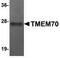 Transmembrane Protein 70 antibody, TA306941, Origene, Western Blot image 