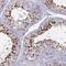 Inhibitory Synaptic Factor 2A antibody, NBP2-48648, Novus Biologicals, Immunohistochemistry paraffin image 