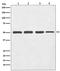 Tubulin Beta 3 Class III antibody, M01857-1, Boster Biological Technology, Western Blot image 