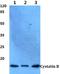 Cystatin B antibody, A02794, Boster Biological Technology, Western Blot image 