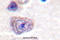 Protein Tyrosine Kinase 2 antibody, A00151Y407, Boster Biological Technology, Immunohistochemistry frozen image 