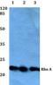 Ras Homolog Family Member A antibody, GTX66647, GeneTex, Western Blot image 