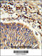 Heat Shock Protein Family A (Hsp70) Member 6 antibody, 63-604, ProSci, Immunohistochemistry paraffin image 