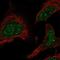 Peroxisome Proliferator Activated Receptor Alpha antibody, NBP2-57777, Novus Biologicals, Immunocytochemistry image 
