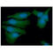 Proteasome 26S Subunit, Non-ATPase 11 antibody, GTX57692, GeneTex, Immunofluorescence image 