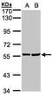 TGF-Beta Activated Kinase 1 (MAP3K7) Binding Protein 1 antibody, PA5-28683, Invitrogen Antibodies, Western Blot image 