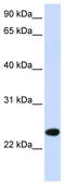 Activating receptor PILR-beta antibody, TA341920, Origene, Western Blot image 