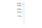 Zinc Fingers And Homeoboxes 2 antibody, 28-708, ProSci, Enzyme Linked Immunosorbent Assay image 