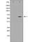 Keratin 5 antibody, orb229186, Biorbyt, Western Blot image 