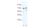 DExD-Box Helicase 21 antibody, 28-486, ProSci, Western Blot image 