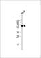 Natriuretic Peptide Receptor 3 antibody, M03589-1, Boster Biological Technology, Western Blot image 