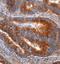 Thrombospondin 1 antibody, AF3074, R&D Systems, Immunohistochemistry paraffin image 