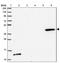 Transmembrane Protein With EGF Like And Two Follistatin Like Domains 1 antibody, NBP2-13441, Novus Biologicals, Western Blot image 