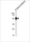 SERPINC1 antibody, MBS9202812, MyBioSource, Western Blot image 
