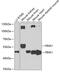 Serine/threonine-protein kinase PINK1, mitochondrial antibody, GTX64362, GeneTex, Western Blot image 