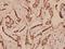 MYB Proto-Oncogene, Transcription Factor antibody, A00157-1, Boster Biological Technology, Immunohistochemistry paraffin image 